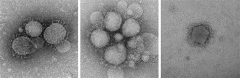 Negative Staining Electron Microscopy for Coronavirus-like?Particle - Creative Biostructure ...