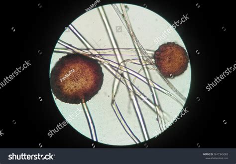 Rhizopus Sp Under Microscope High Power Foto de stock 1617345085 ...