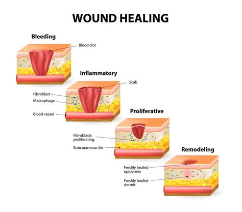 Vitamins, Supplements and Wound healing : Jenna Wishnew, MD, FACS ...