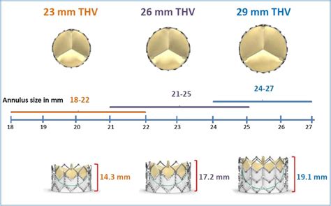 Transcatheter aortic valve implantation: the procedure | Heart