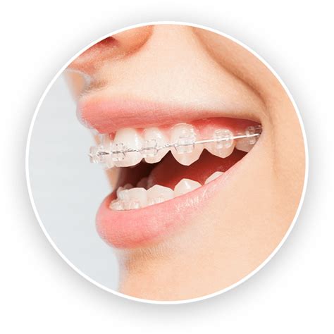 Lakeshore Orthodontics - Ludington, Whitehall, Grand Haven, Holland