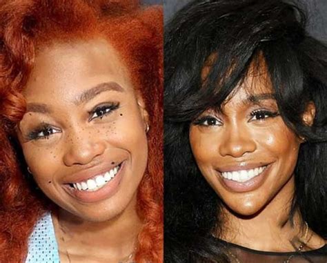 SZA Plastic Surgery: Boobs (Boob Job), Nose Job, Lip Fillers