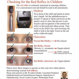 The ethnic origin of patients referred with abnormal red reflexes | Download Table