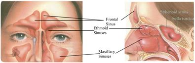 Rhinosinusitis 101 Arizona Sinus Center * What are the Sinuses ...