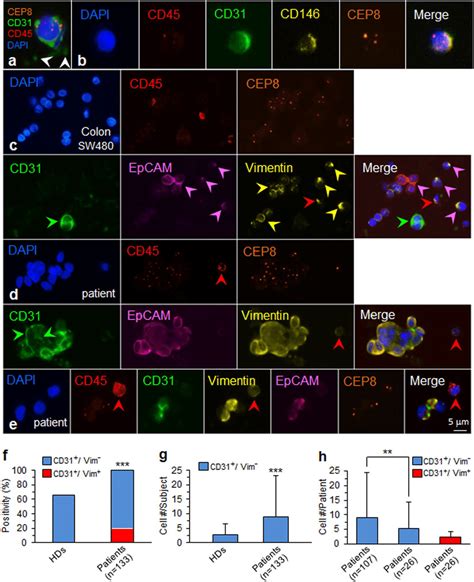 Characterization of aneuploid CECs and in situ co-detection of... | Download Scientific Diagram