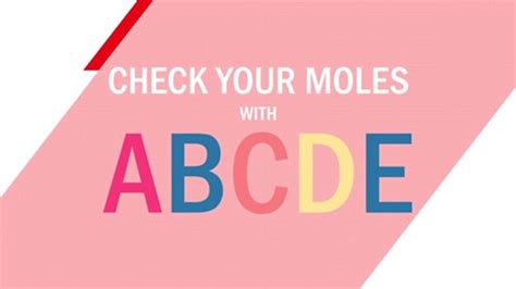 Watch: This is the 'ABCDE' rule for checking moles | Metro Video