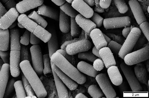 Bacillus cereus - Microbiology - Medbullets Step 1