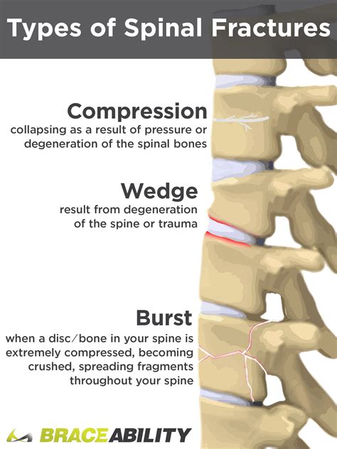 What Does it Mean If I’ve Been Diagnosed with a T12 or L1 Vertebral ...