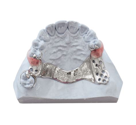 Cast Metal Partial Denture Reline or Rebase: Is It Worth It? – STOMADENT
