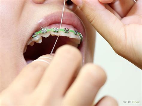 How to Floss With Braces | Dental flossing, Flossing, Braces dos and donts