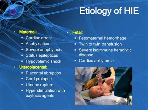 Hypoxic Ischemic Encephalopathy