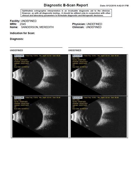 B-Scan Plus - Ophthalmic Ultrasound Equipment