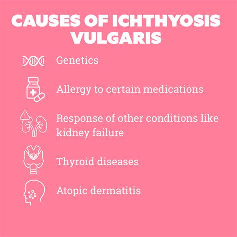 Ichthyosis vulgaris: Causes, Symptoms, Treatment and Expert Tips