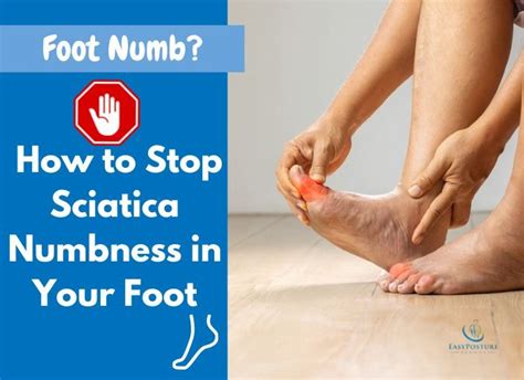 Sciatica Numb Foot - How to Stop Sciatica Numbness in Foot - Easy ...