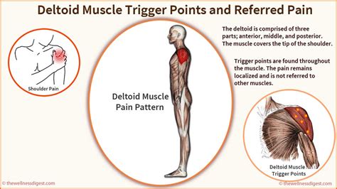 Deltoid Tendonitis Causes Symptoms Treatment Exercise - vrogue.co