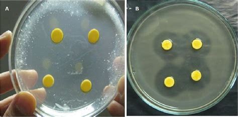 Antimicrobial assay plate for the antibacterial activity of P. guajava... | Download Scientific ...