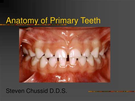 PPT - Anatomy of Primary Teeth PowerPoint Presentation, free download ...