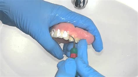 Denture Cleaning Using the Ultrasonic - YouTube