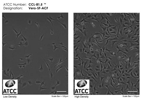 Vero cells, the green monkey kidneys cells used to produce vaccines