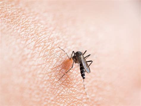 Mosquito Bite on Human Skin Stock Image - Image of infection, focus ...