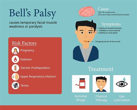 Bell's Palsy Handbook: Facial Nerve Palsy Or Bell's Palsy Facial Paralysis Causes, Symptoms ...