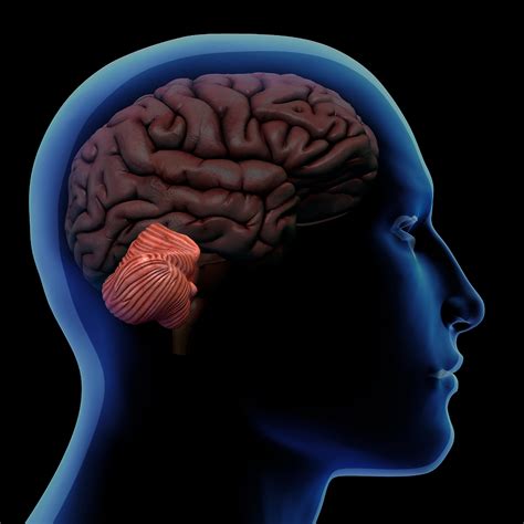 Guide to Cerebellum Stroke | Neurolutions