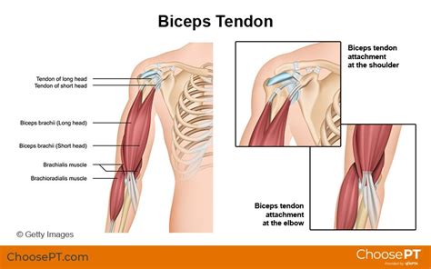 Physical Therapy Guide to Biceps Tendon Rupture — Pro Dynamic Physical ...