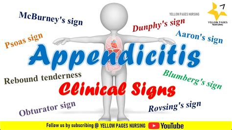 Clinical signs of Appendicitis | NCLEX REVIEW - YouTube