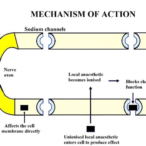 Diagrammatic representation of the mechanism of action of Local anesthesia. | Download ...