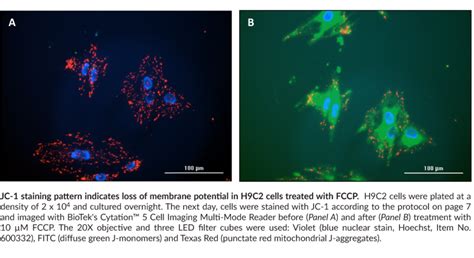 JC-1 Mitochondrial Membrane Potential Assay Kit