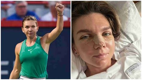 Simona Halep Undergoes Nose Surgery; Rendered Unable To Play Until 2023