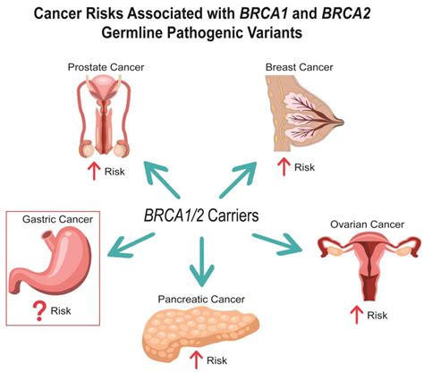 Cancers | Free Full-Text | Gastric Cancer Risk and Pathogenesis in ...