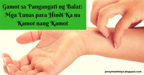 Gamot sa Pangangati ng Balat: Mga Lunas para Hindi Ka na Kamot nang Kamot