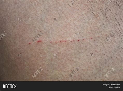 Wound Scratching Cat Image & Photo (Free Trial) | Bigstock