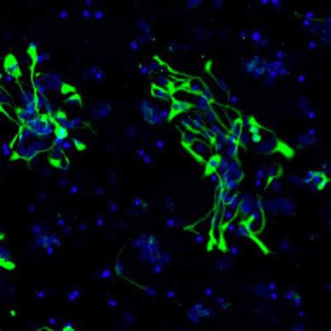 Human iPSC-derived Neural Progenitor cells (Caucasian, 1M cells)0.5 mL ...