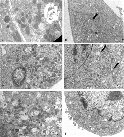 Electron microscopy of samples of muscle fibers from wild-type (a-c ...