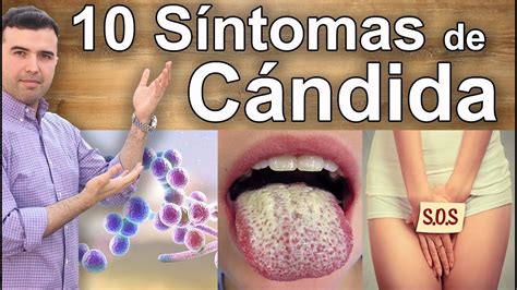 Síntomas Y Signos Que Indican Que Tienes Candidiasis - 10 Síntomas Que No Debes Ignorar - YouTube