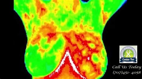 Vacaville Thermography – Center for Holistic Health & Nutrition