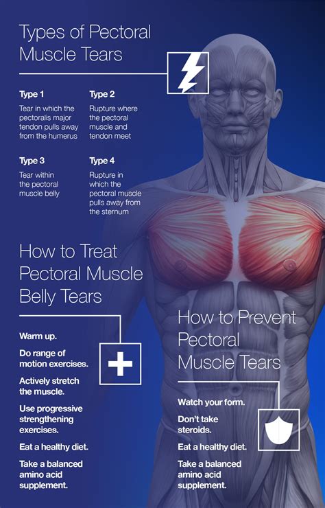 Torn Pectoral Muscle Symptoms