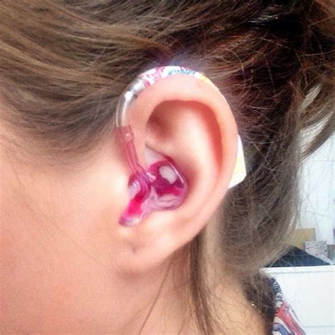 Les 35 meilleures images du tableau Hearing Aid Accessories sur Pinterest | Les implants ...