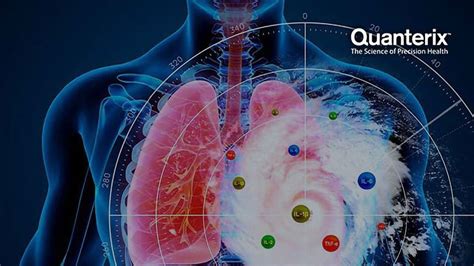 Cytokine Profiles and Personalized Therapeutics in COVID-19 Patients | Technology Networks