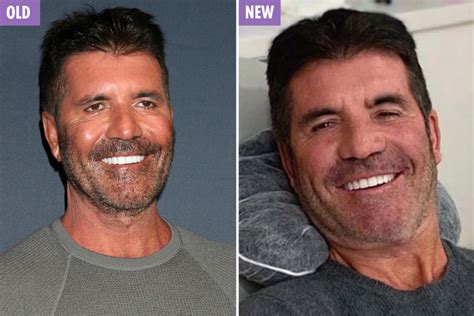 Simon Cowell looks back to his best as he poses with dentist after ...