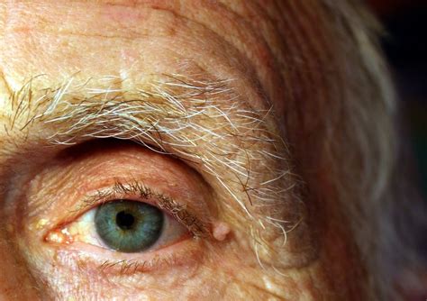 Some Of The Common Eye Diseases In Elderly People - Goggles4u.com