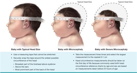 Measuring Head Circumference – Richmond Hill Children's Clinic