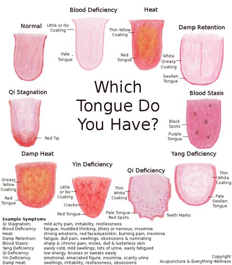 Why Do You Look At My Tongue? – Amherst Wellness Center