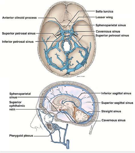 Schematic drawings of the dural venous sinuses of the skull base noting ...