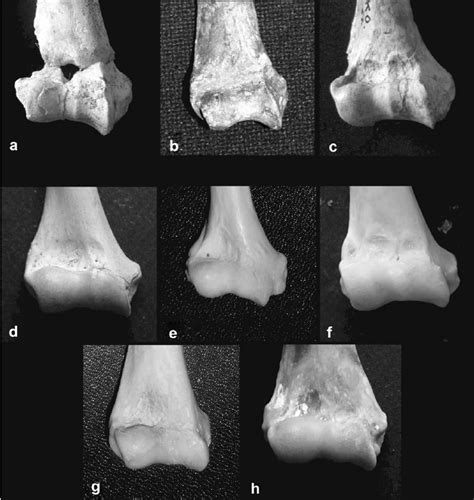 Anterior view of the distal humerus of fossil and extant Colobinae: (a ...