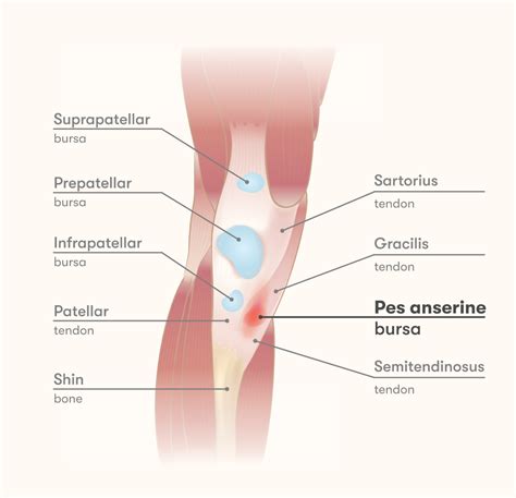 Pes Anserinus Pain Syndrome - Pregnancy Informations