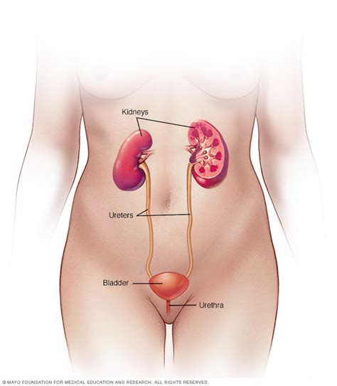 Urinary tract infection (UTI) Disease Reference Guide - Drugs.com