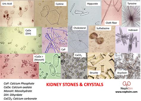 Idexx Urine Sediment Guide